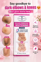 Aichun Beauty Whitening Lotion for Elbows