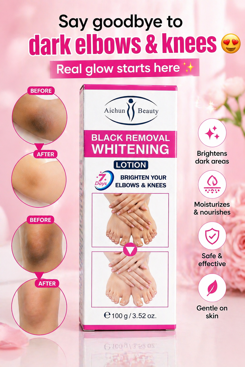 Aichun Beauty Whitening Lotion for Elbows